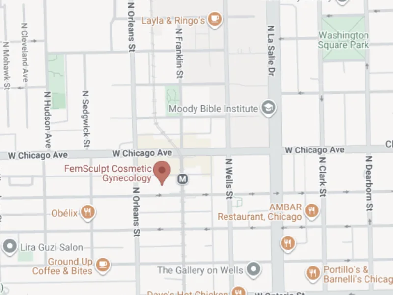 Map showing FemSculpt at 310 W Superior St in Chicago's River North