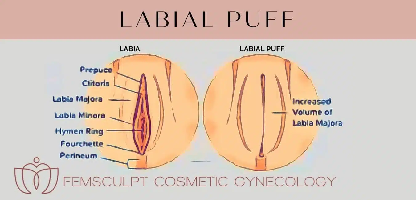 Diagram of the labial puff.