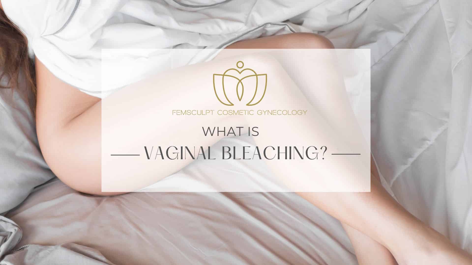 What is vaginal bleaching?