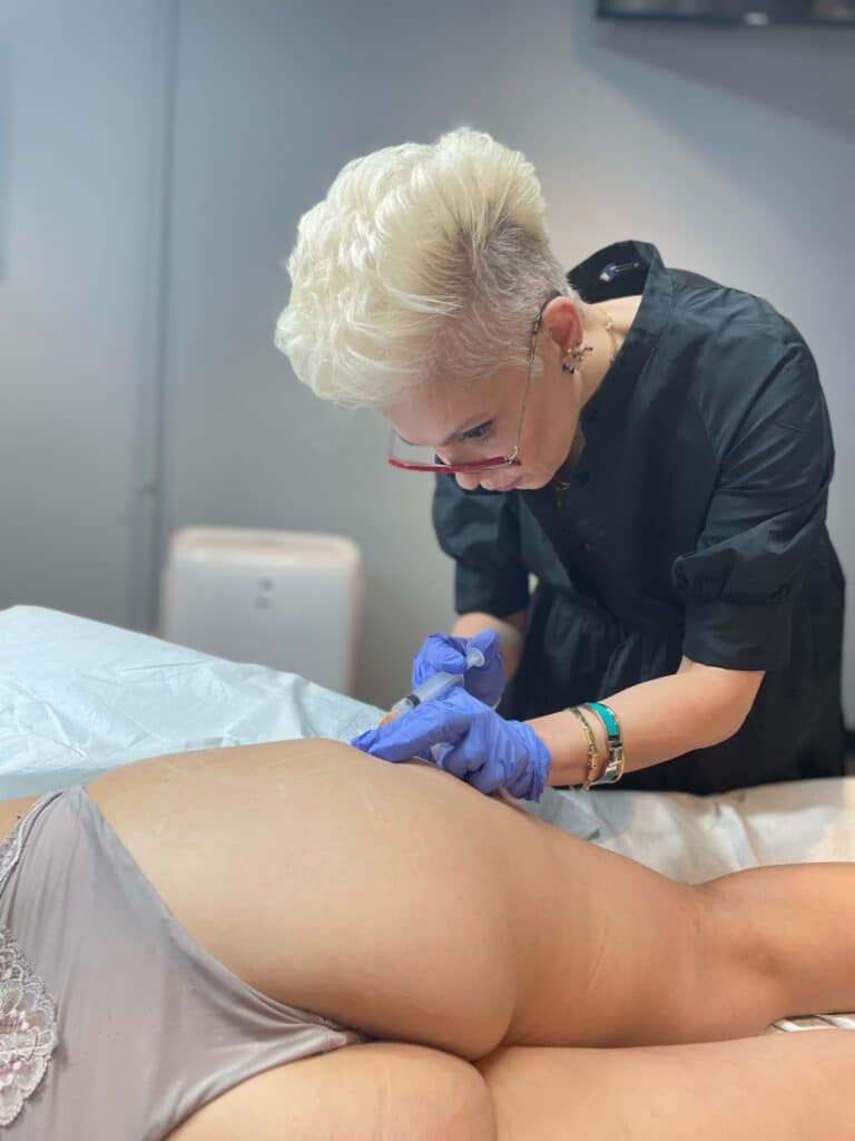 Sculptra Buttock Injections Chicago Illinios Dr. Sue Kafal